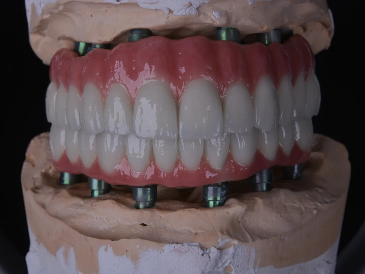Citydent Istanbul in-house dental laboratory — zirconia fabrication