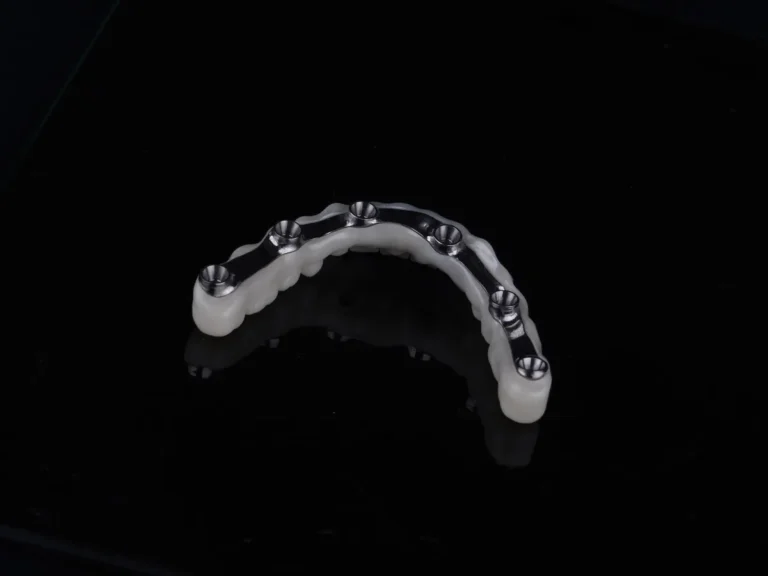 Restauration complète sur six implants à Istanbul – CityDent