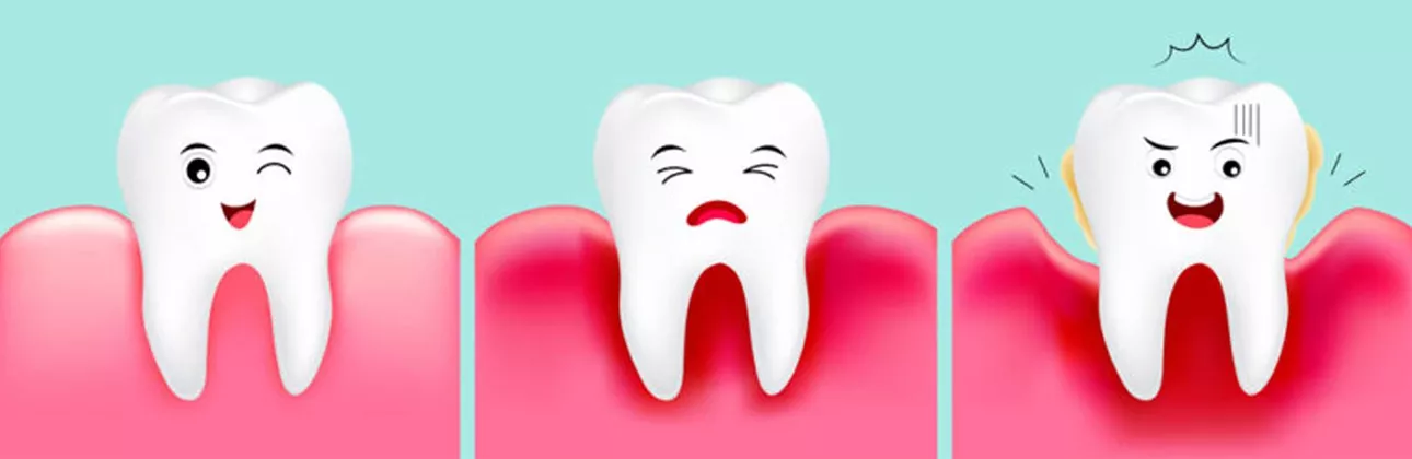 Patient at dental consultation for bad breath assessment — CityDent Istanbul