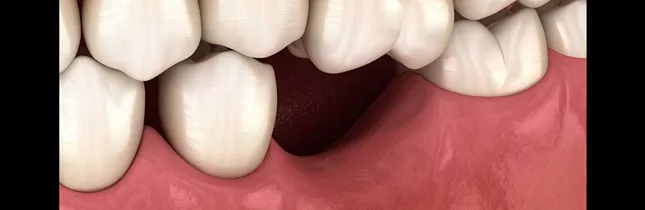 Loose tooth examination at CityDent Istanbul dental clinic