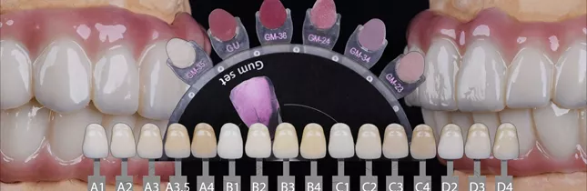 Natural tooth color shade guide — CityDent Istanbul