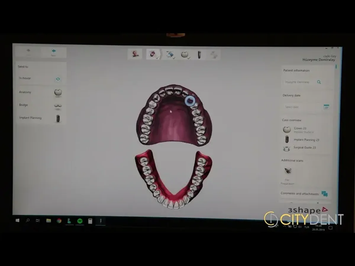 Smile design consultation at Citydent Istanbul dental clinic