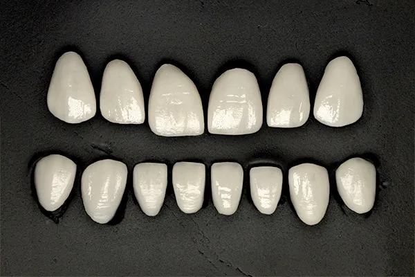 Porcelain veneers in Istanbul