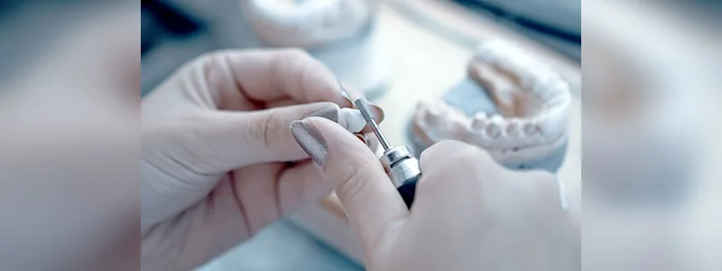 CityDent in-house dental laboratory