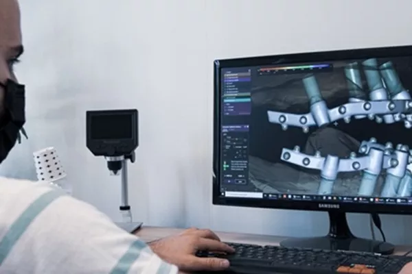 خيارات تيجان السيراميك والزيركون المثبتة بالبراغي على زرعة الأسنان