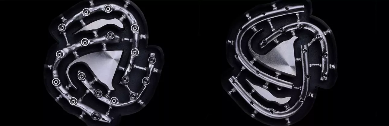 Illustration d'une prothèse amovible sur barre en titane fixée aux implants